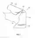Fig. 08 - Distal femur cutting block and method of using the same