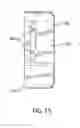 Fig. 16 - Distal femur cutting block and method of using the same