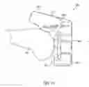 Fig. 22 - Distal femur cutting block and method of using the same