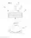 Fig. 04 - Choking intervention device and method of use thereof