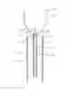 Fig. 01 - Methods and Systems for Submucosal Implantation of a Device for Diagnosis and Treatment of a Body
