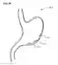 Fig. 34 - Methods and Systems for Submucosal Implantation of a Device for Diagnosis and Treatment of a Body