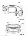 Fig. 19 - Methods, Systems and Devices for Surgical Access and Insertion