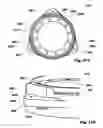 Fig. 40 - Methods, Systems and Devices for Surgical Access and Insertion