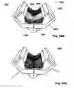 Fig. 56 - Methods, Systems and Devices for Surgical Access and Insertion