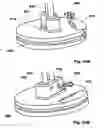 Fig. 70 - Methods, Systems and Devices for Surgical Access and Insertion