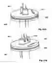 Fig. 72 - Methods, Systems and Devices for Surgical Access and Insertion