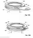 Fig. 86 - Methods, Systems and Devices for Surgical Access and Insertion
