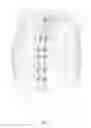 Fig. 04 - Spinal correction system and method