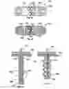 Fig. 05 - ORTHOPAEDIC STABILISATION DEVICE