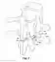 Fig. 06 - Facet device and method