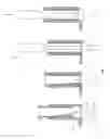 Fig. 16 - BONE SCREW RETAINING SYSTEM