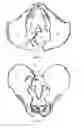 Fig. 07 - Bone screw fixation system