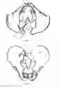 Fig. 08 - Bone screw fixation system