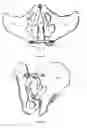 Fig. 09 - Bone screw fixation system