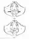 Fig. 10 - Bone screw fixation system