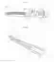 Fig. 04 - Electrosurgical sealing and transecting devices and methods with improved application of compressive force