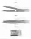 Fig. 07 - Electrosurgical sealing and transecting devices and methods with improved application of compressive force