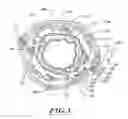 Fig. 04 - Non-invasive and minimally invasive denervation methods and systems for performing the same