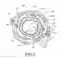 Fig. 06 - Non-invasive and minimally invasive denervation methods and systems for performing the same