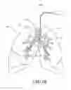 Fig. 08 - Non-invasive and minimally invasive denervation methods and systems for performing the same