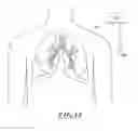 Fig. 10 - Non-invasive and minimally invasive denervation methods and systems for performing the same