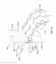 Fig. 13 - SYMPATHETIC NERVE ABLATION DEVICES WITH AN EXPANSION-LIMITING MEMBER
