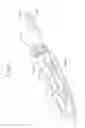 Fig. 09 - Catheter with liquid-cooled control handle