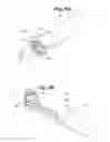 Fig. 05 - Surgical navigation for repair of heart valve leaflets