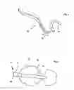 Fig. 03 - Intraoral protection