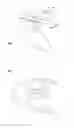 Fig. 04 - Intraoral protection