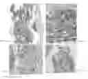 Fig. 03 - Dental implant