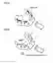 Fig. 04 - Full denture base manufacturing method