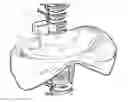 Fig. 01 - DIAPHRAGM ASSIST DEVICE