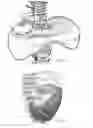 Fig. 02 - DIAPHRAGM ASSIST DEVICE