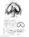 Fig. 04 - DIAPHRAGM ASSIST DEVICE