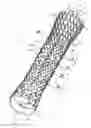 Fig. 01 - Esophageal stent with valve