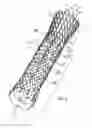 Fig. 02 - Esophageal stent with valve