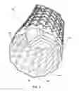 Fig. 06 - Esophageal stent with valve