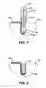 Fig. 06 - Graft introducer
