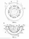 Fig. 02 - Deformable prosthesis