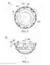 Fig. 04 - Deformable prosthesis