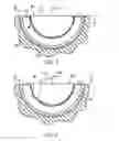 Fig. 06 - Deformable prosthesis