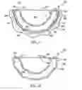Fig. 08 - Deformable prosthesis