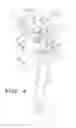 Fig. 04 - Orthopedic prosthesis with suture anchor features
