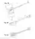 Fig. 07 - Biologic vertebral reconstruction
