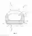 Fig. 02 - Spinal implant system and method