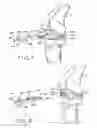 Fig. 08 - Provisional tibial prosthesis system