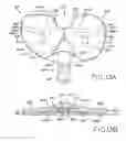Fig. 14 - Provisional tibial prosthesis system