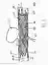 Fig. 02 - MEDICAL DEVICES INCLUDING METALLIC FILMS AND METHODS FOR MAKING SAME